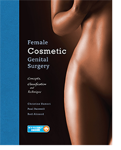 Female Cosmetic Genital Surgery